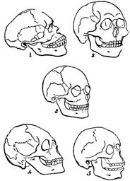 head